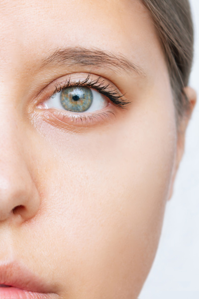 Blepharoplasty